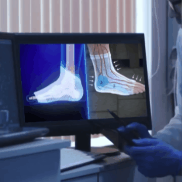 GYMFOOT – Obtenez un soulagement instantané des pieds gonflés et douloureux